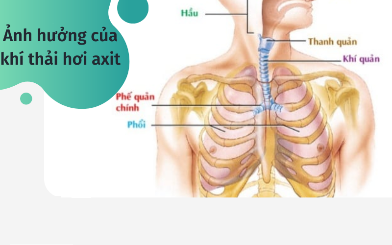 xử lý khí thải 